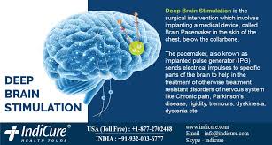 Pin On Neuro Brain Surgery
