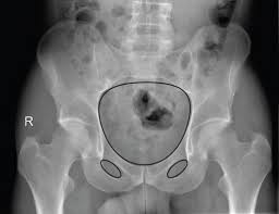 This mri male pelvis axial cross sectional anatomy tool is absolutely free to use. Pelvis And Hip Radiology Key