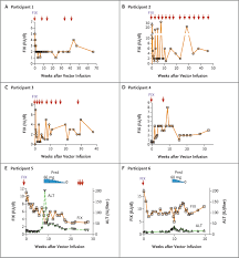 Image result for Black 1999 AAV