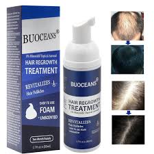 My hair was falling out in clumps and getting super thin in the front, explained reviewer cyferguson. Hair Growth Products Hair Regrowth Hair Growth Treatment Hair Loss Hair Thinning Treatment Extra Strength Hair Growth Treatment Foam One Month Supply Buy Online In Saint Vincent And The Grenadines At