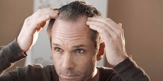 Your body can't make it, so you need to get it from food or supplements. The Only 4 Things That Can Actually Prevent Hair Loss