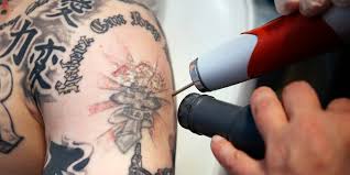Use a mild, unscented liquid antibacterial or antimicrobial soap to rub the tattoo gently with your fingers, removing all traces of blood, plasma, or leaked ink. A Guide To Everything You Should Know About Tattoo Removal