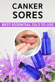 Pain from a canker sore tends to get better in a few days, and the sores usually heal without treatment in about a week or two. Best Essential Oils For Canker Sores Diy Blend Recipe Pumps Iron