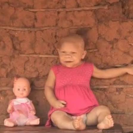FUTRIKEI🤯😱 | Mulher de 30 anos viveu com corpo e desenvolvimento de bebê  por causa de doença não tratada María Audenete nasceu no Ceará, em uma  região... | Instagram