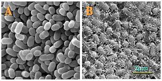 Este important de stiut ca nu orice bolnav care are o infectie urinara prezinta simptome, dar majoritatea acestor persoane au cel putin un simptom care poate fi manifestat. Escherichia Coli EnterohemoragicÄƒ Wikipedia