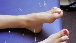 A Close Up Look At Acupuncture For Pain Abc News