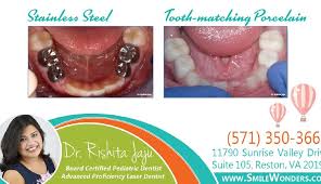 Pediatric Fillings Vs Pediatric Crowns Smile Wonders