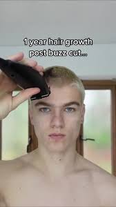 James Edwards Hair Growth