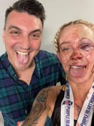 BKFC's KnuckleMania Super Star Taylor “Killa Bee” Starling Tells ALL -