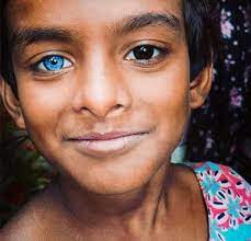 As Humans We Are All Special In Our Own Ways But A Small Percentage Of Us Are Quirkier Than The Rest Change Your Eye Color Different Colored Eyes Pretty Eyes