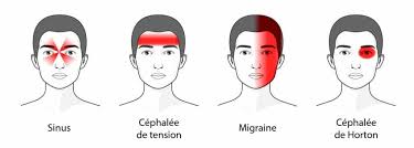 Yeux qui pique, brule = sinusite ? Meilleurs Appareils De Massage Des Yeux Avis Comparatif Oculaire