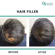 O2 klinik was founded in january 2012 by a group of medical doctor with the aim of providing services in general medicine; O2klinik Instagram Profile With Posts And Stories Picuki Com