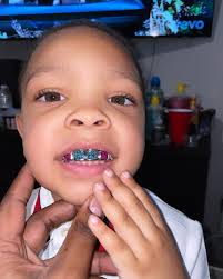 Son Bling Blow Wowww 😱🤩