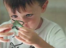 Resultado de imagen para caracteristicas del sindrome cromosoma x fragil