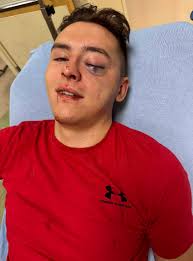 Navy seals visit young boy before surgery