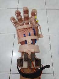 Salah satu cara paling mudah dalam menyiasati sarung tangan agar bisa digunakan menyentuh layar smartphone adalah dengan menggunakan benang konduktif. Mahasiswa Um Surabaya Bikin Alat Penggerak Jari Bantu Terapi Pasien Stroke