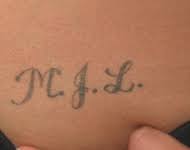 I'm finally getting a tattoo the end of august, before i go back to school. Tattoo Removal Long Island Garden City Great Neck Hamptons Hempstead Oyster Bay