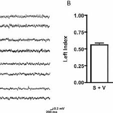 Luego pablo pandolfo formó otra agrupación exitosa: Pablo Pandolfo Laboratory Head Ph D Universidade Federal Fluminense Niteroi Uff Departamento De Neurobiologia Gne