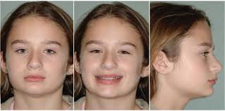 SAO Spring 2024 Newsletter by Southern Society of Orthodontists