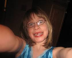 Snapz: Toothless Grins Photo Gallery