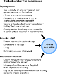 Image result for Intrapleural Anesthesia