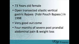 Image result for Single Breath Counting