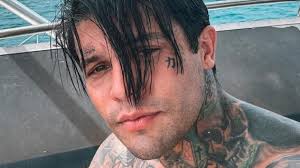 Yeferson Cossio tuvo un accidente dental y tuvo que ir de urgencias -  LaKalle