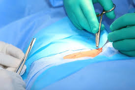 The skin's surface qualities—moisture, hair, oil, and shedding dead cells—make psa adhesion challenging. Surgical Wound Care Questions And Answers