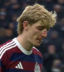 Not sure how Eddie Lowrie got the hand cut after appeal