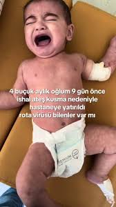 Rota Virüsü Nedir? Oğlumun Hastalığı Hakkında Bilgi