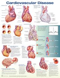 Cardiovascular Disease Anatomical Chart Company
