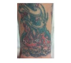 It is important to determine why and where the inflammation has occurred and which type of. Man Has Skin Reaction To Tattoo 20 Years Later Live Science