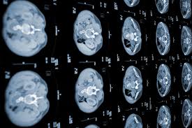 Now i have felt a large number of abdominal masses and i can tell you that every single time i felt one in an older cat it was very bad news. Uspstf Still Recommends Against Pancreatic Cancer Screening Oncology Nurse Advisor