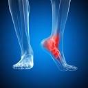 Foot & Ankle Surgery in Plano, Frisco, McKinney and Allen