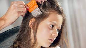 Near you 20+ hair extension services near you. Headlice Everything You Don T Want To Know