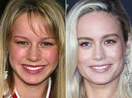 Gloria grahame hallward was born in los angeles, california. Brie Larson In 2003 L 2019 Plastic Surgery Lip Plastic Surgery Aesthetic Dermatology