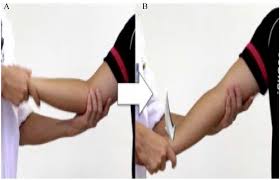 Image result for Elbow Extension Test