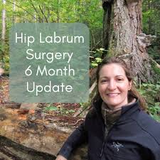 6 Month Update After Hip Labral Tear Surgery The Roving Fox Hip Surgery Recovery Surgery Hip Arthroscopy