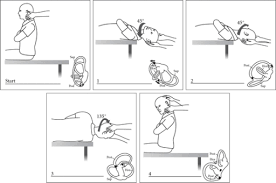 The patient sits upright and turns head 45° towards the right (affected ear). How Pt Can Treat Dizziness In One Visit Whole Body Health Physical Therapy Portland Oregon