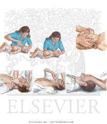 This page is about head tilt chin lift,contains airway management,cardiopulmonary resuscitation (cpr),when should cpr be performed on a victim?,resuscitation and more. Head Tilt Chin Lift And Jaw Thrust Maneuvers