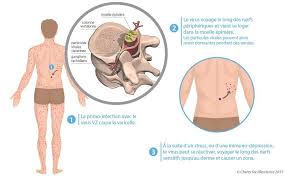Epingle Sur Fiches Sante