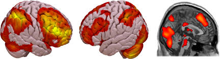 Rtpj simply were not involved in the process of moral judgment. The Role Of The Right Temporo Parietal Junction In Social Decision Making Bitsch 2018 Human Brain Mapping Wiley Online Library