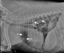 Secondary lung tumors are neoplasms that spread from a primary lesion. Image Gallery Primary Metastatic Tumors Part 1 Clinician S Brief