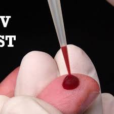 Your results will be confidential and the healthcare provider will be able to explain the process and answer any questions you have. Cara Cara Nak Buat Hiv Test Untuk Bakal Pengantin