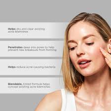 Amazon.com: Glytone Acne Spot Treatment Face Cream with 8% Sulfur & 2%  Resorcinol, Tinted Acne Treatment for Teenagers, Conceals Blemishes, 1 oz :  ...