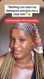 Tired of flakes and dandruff? Here's how to get rid of dandruff and dry  scalp from a board-certified dermatologist. #dandruff #dryscalp  #dandrufftreatment #fyp