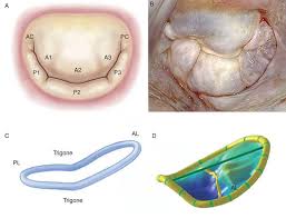 The mitral valve (mitral valve) is also known as the bicuspid valve or the left atrioventricular valve. Surgical Echocardiography Of The Mitral Valve Revista Espanola De Cardiologia