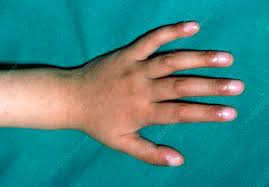 Image result for Digital Clubbing