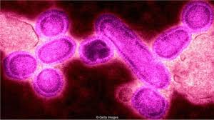 Penyakit berikutnya yang disebabkan virus adalah mata merah (belek). Penyakit Flu Yang Mengubah Abad Ke 20 Menghilangkan Satu Generasi Dan Memperbaiki Layanan Kesehatan Bbc News Indonesia
