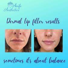 Aoife Aesthetics (@aoife_aesthetics) • Instagram photos and videos